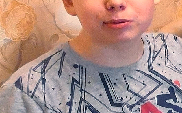 Здоровая чистая кожа