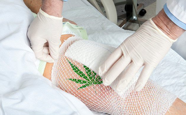 Заживление ран послеоперационных пациентов